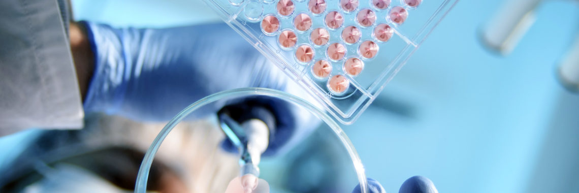 analytical chem excite pharma